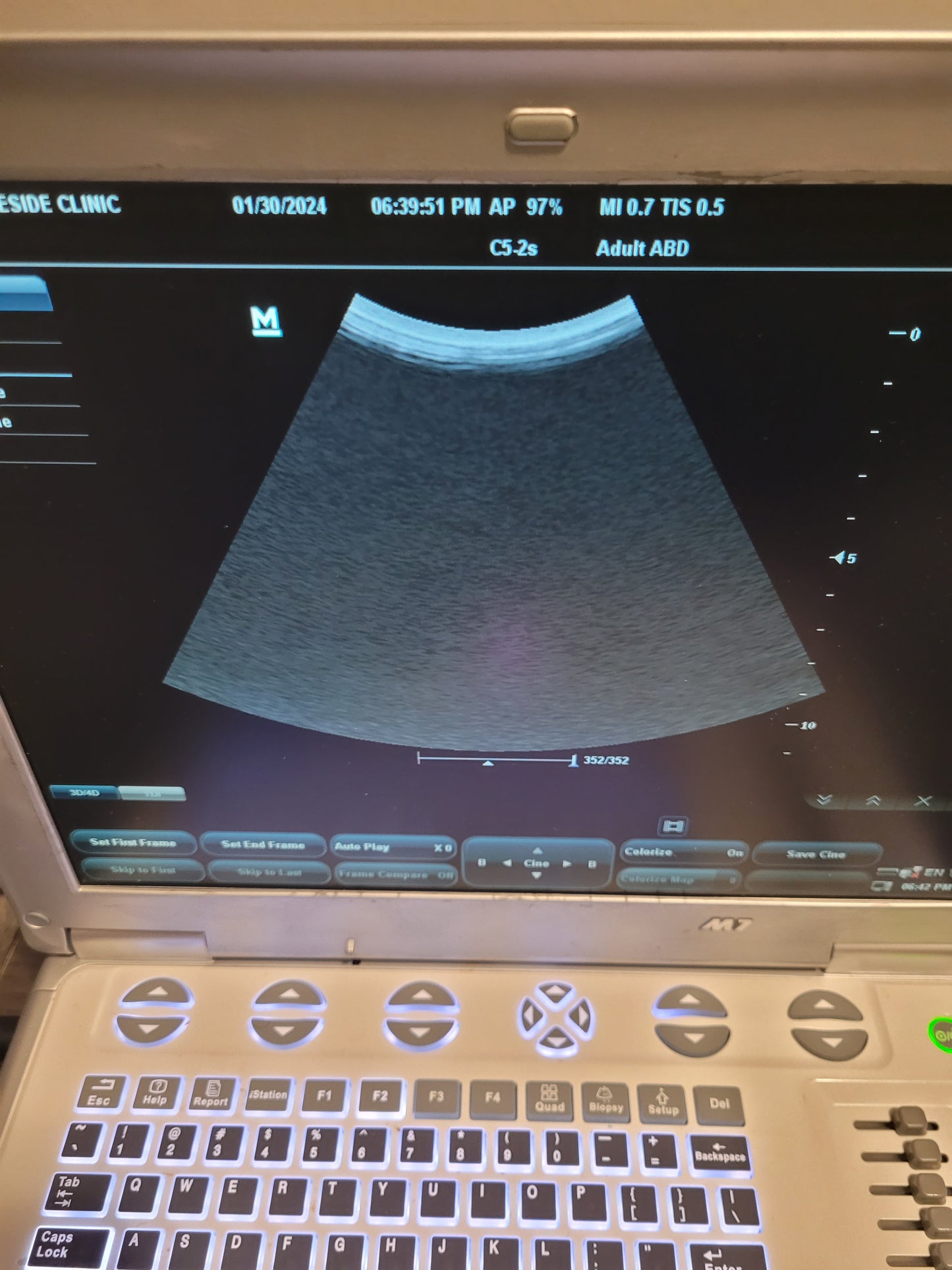 Mindray M7 Ultrasound with Probe