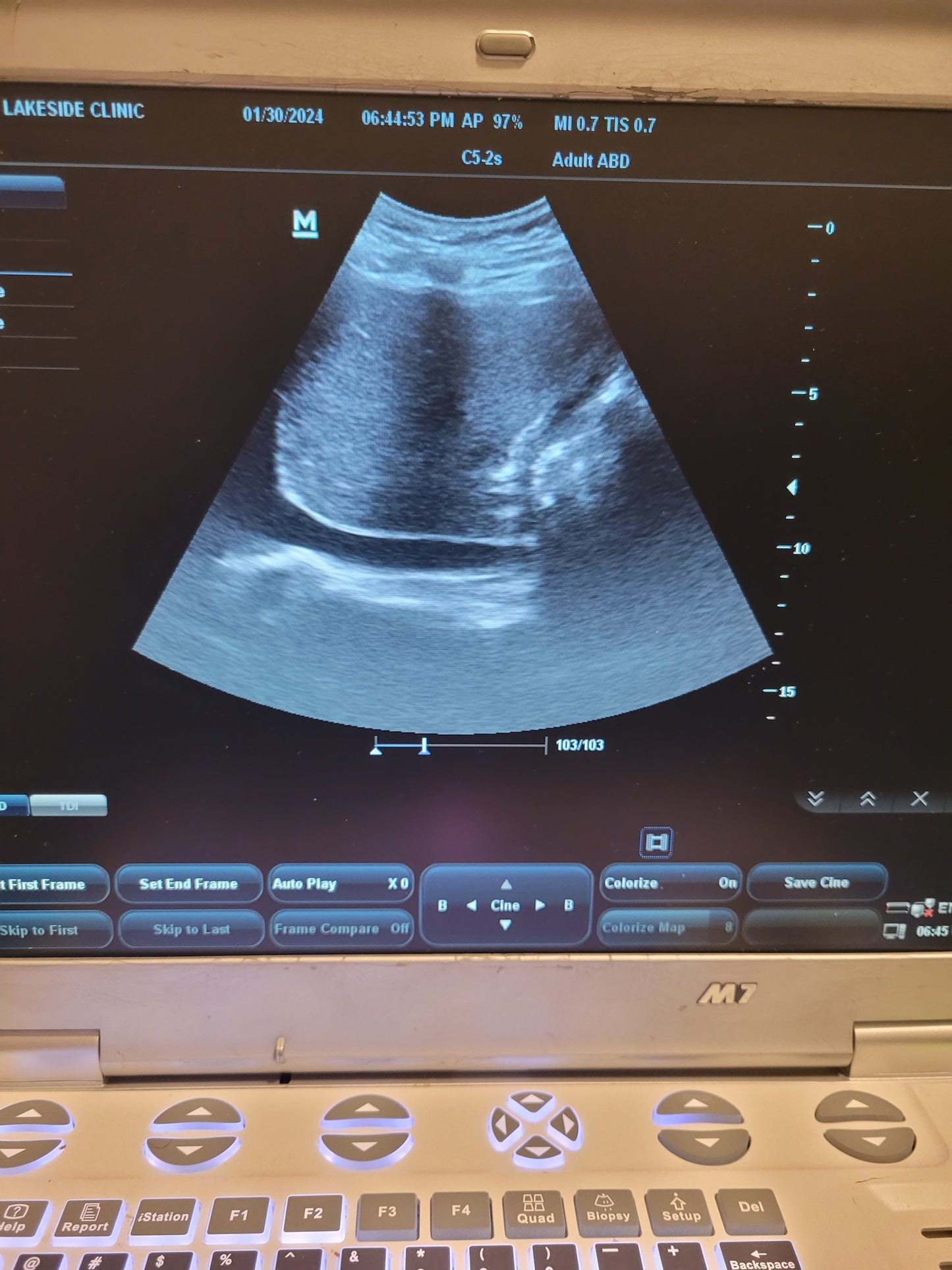 Mindray M7 Ultrasound with Probe