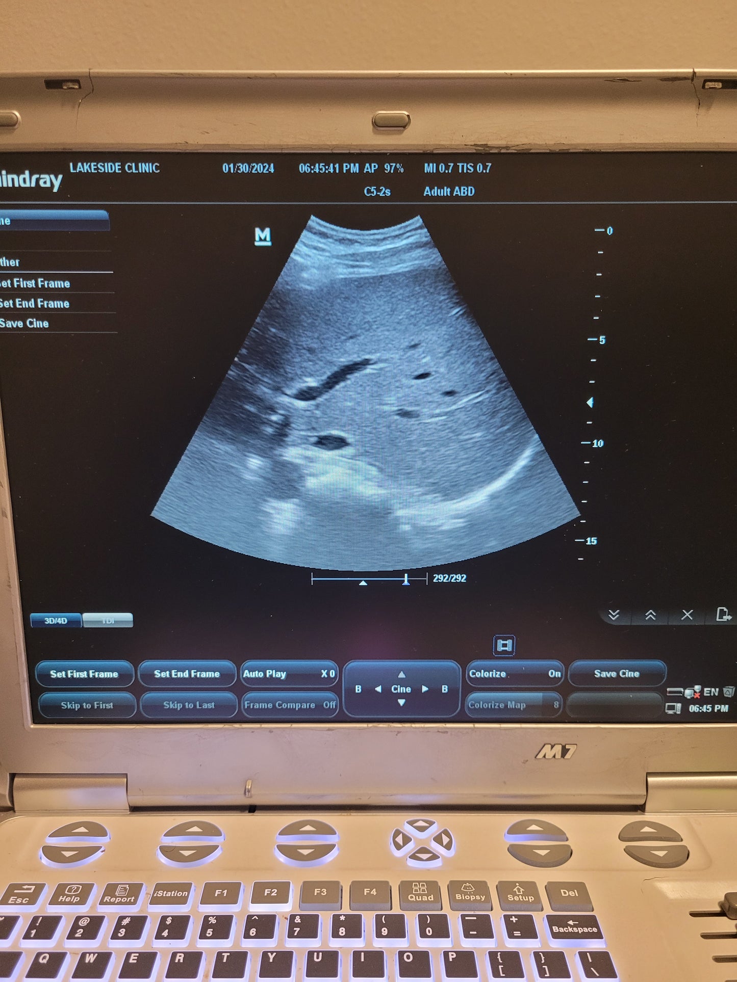 Mindray M7 Ultrasound with Probe