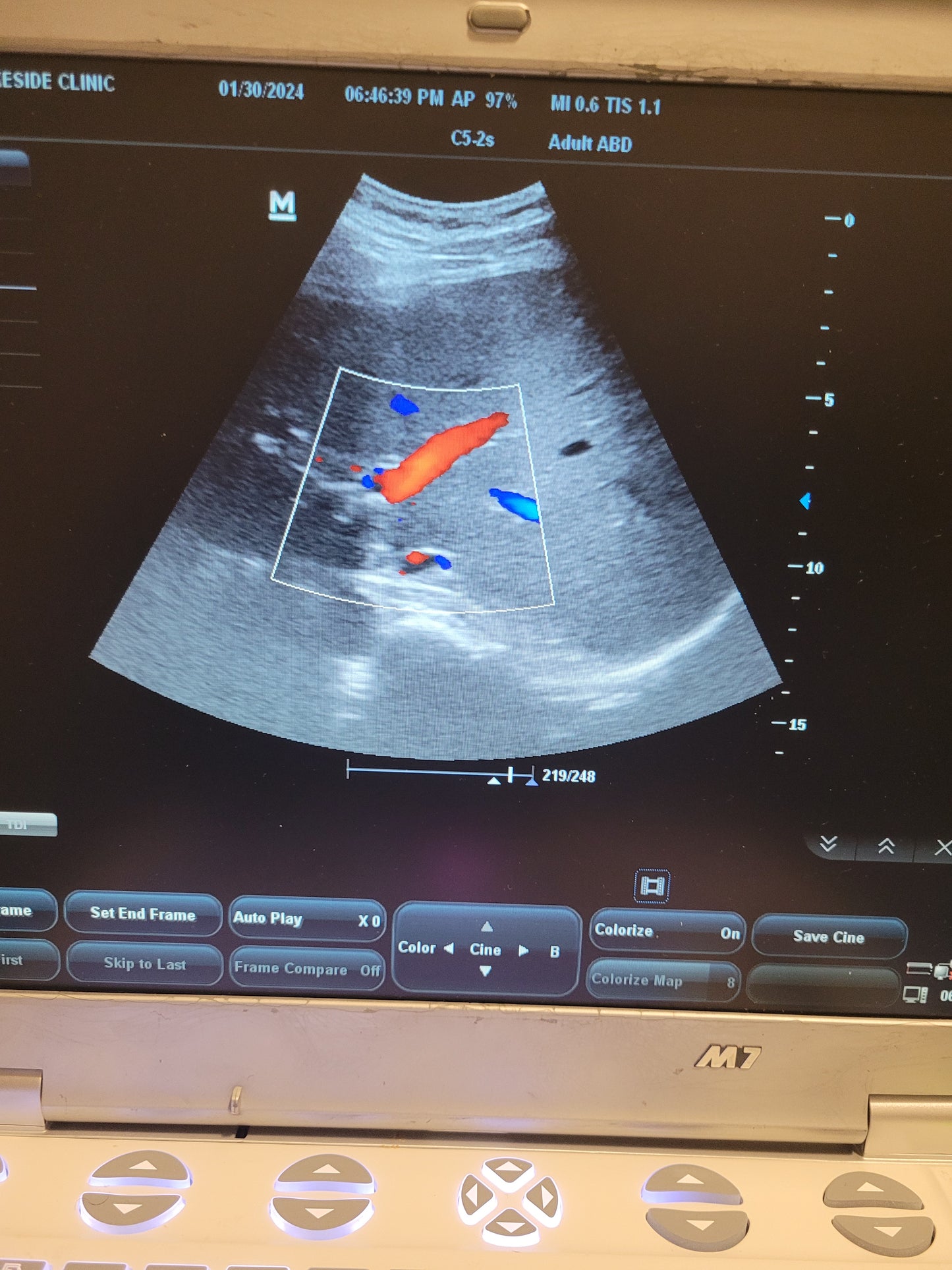 Mindray M7 Ultrasound with Probe