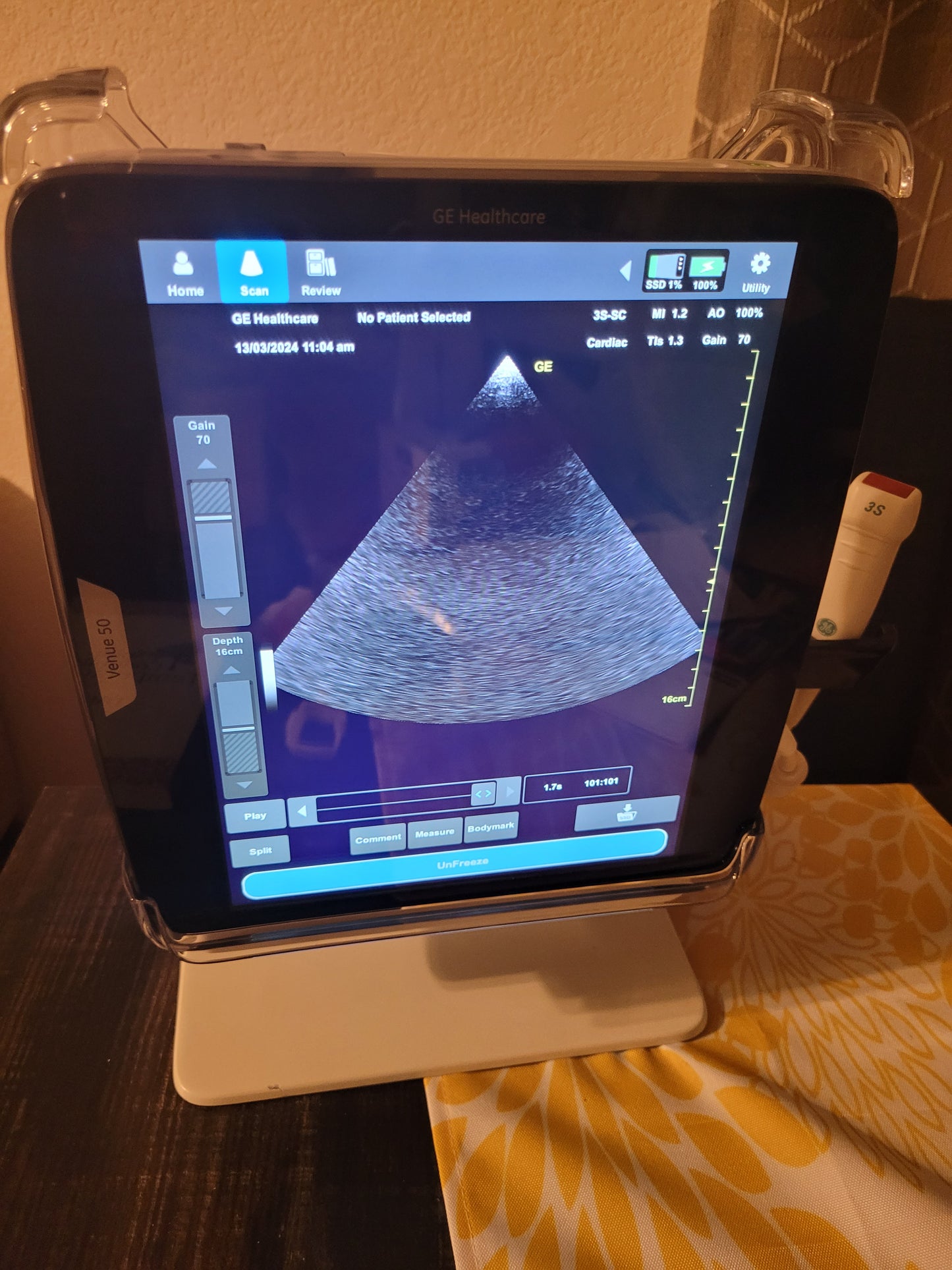 Ge venue 50 Ultrasound with portable dock and cardiac probe