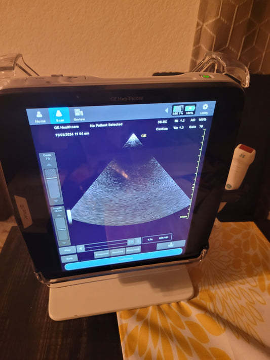 Ge venue 50 Ultrasound with portable dock and cardiac probe