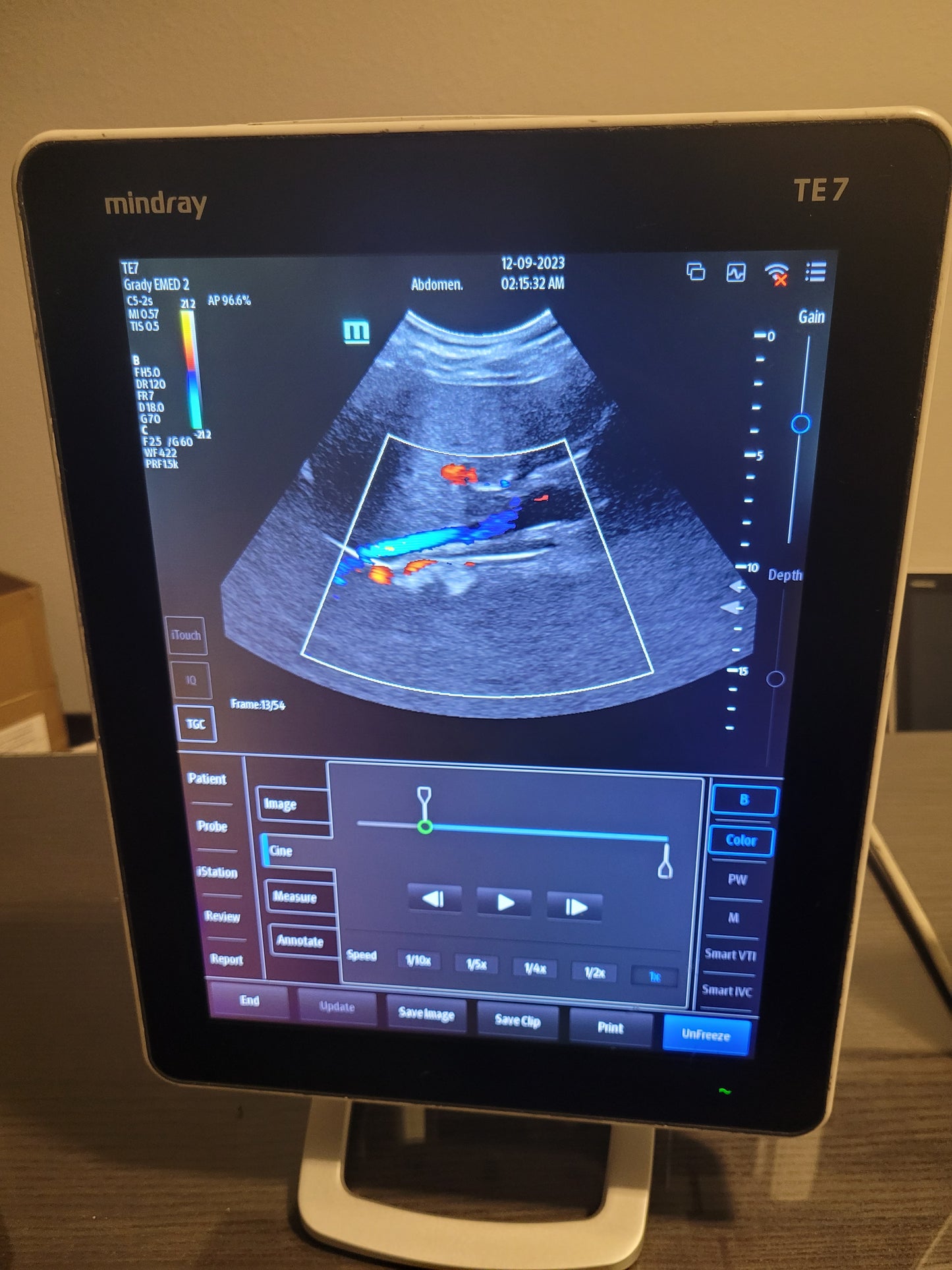 Mindray TE7 Ultrasound Machine With Convex Transducer YOM 2019