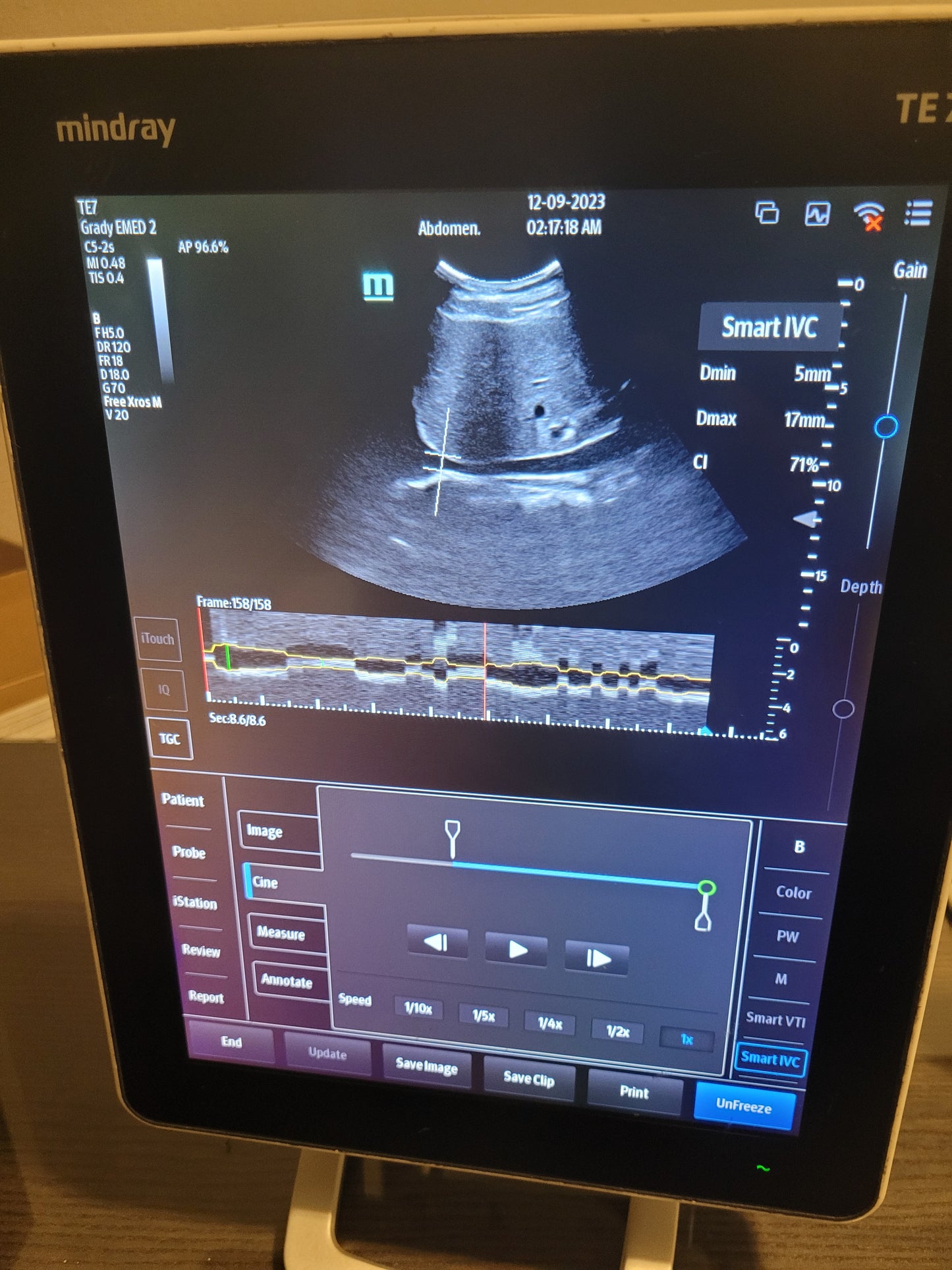 Mindray TE7 Ultrasound Machine With Convex Transducer YOM 2019