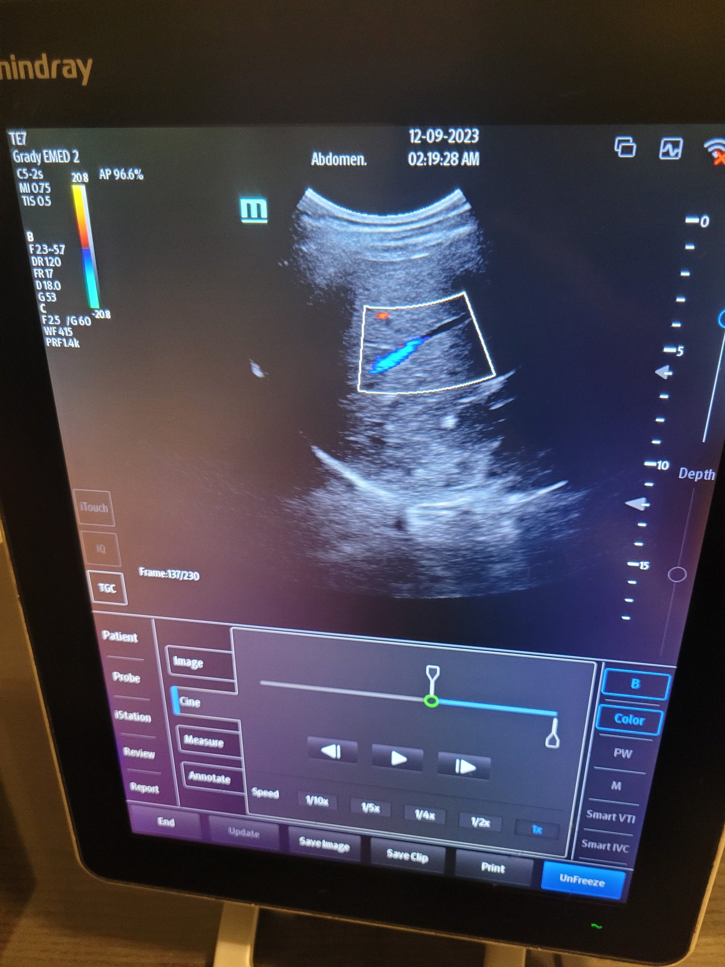 Mindray TE7 Ultrasound Machine With Convex Transducer YOM 2019